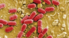 Alertă privind E.coli entero-hemoragica