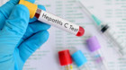 Testări pentru persoanele cu risc de hepatita C