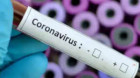 38 de noi cazuri de infectări cu COVID-19, la Cluj